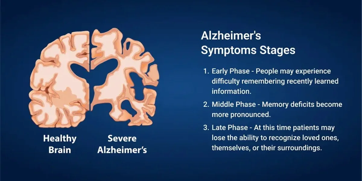 Diese 3 Anzeichen bei meinem Mann (46) waren KEIN Stress – sondern Alzheimer - image 1