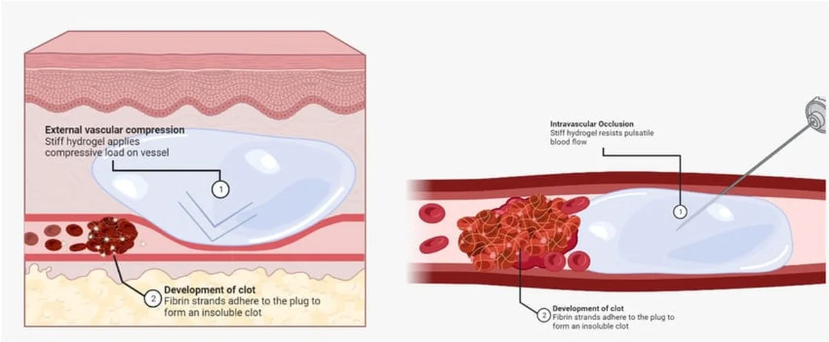 Du glaubst, Brust-OPs brauchen eine Auszeit? Ärzte nutzen jetzt Fett von Toten und das in unter 2 Stunden! - image 2