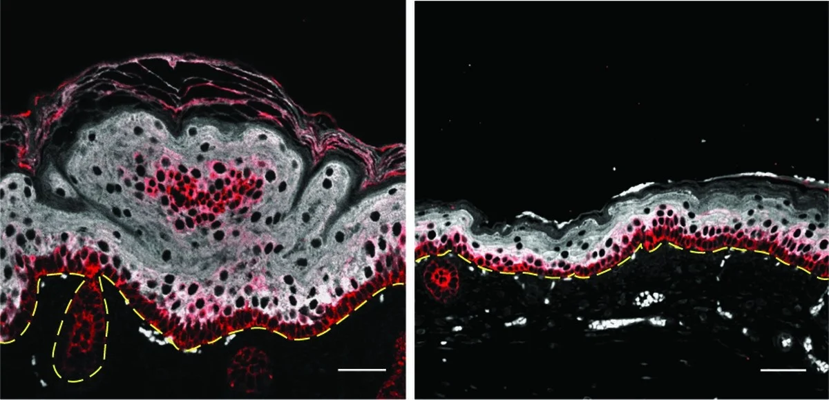 Haut-Schock: Ihre Bräune ist älter als Sie denken – das sagen die Gene! - image 2