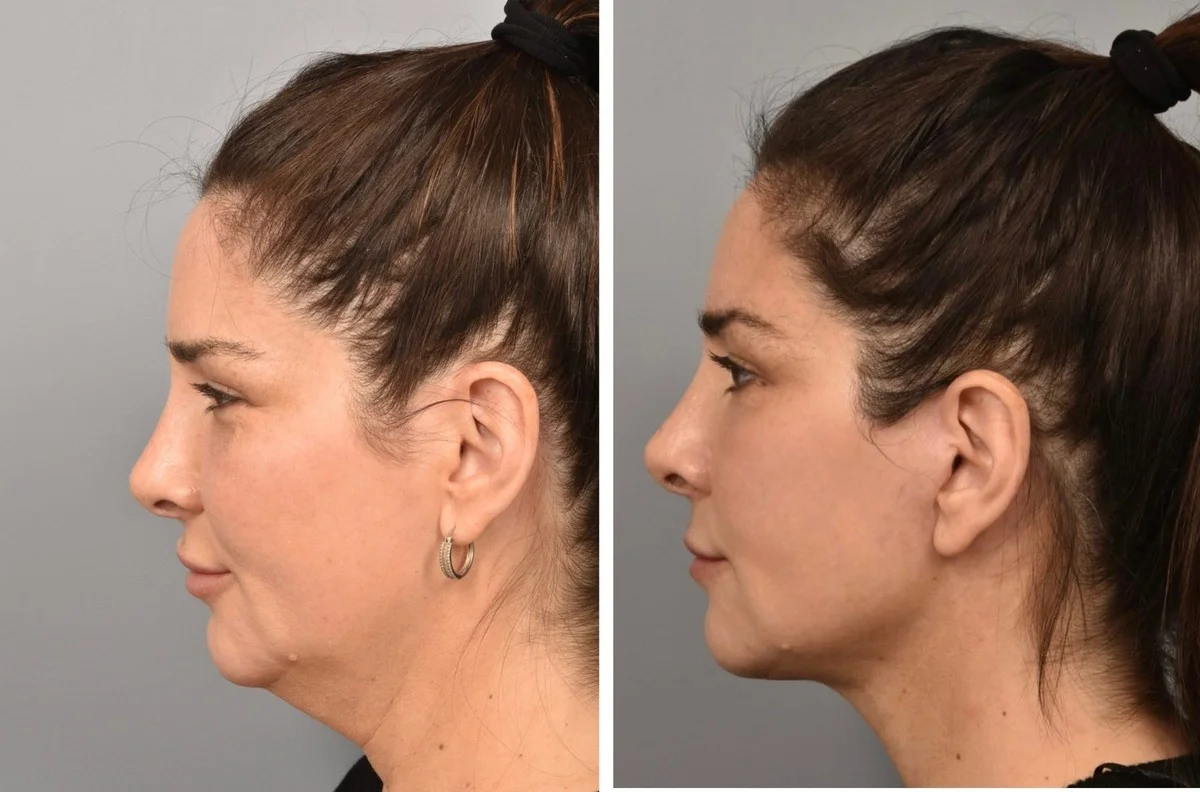 Dieser heimliche Schönheits-Boost ist Ihr neuer Business-Vorteil – aber Sie reden nicht darüber