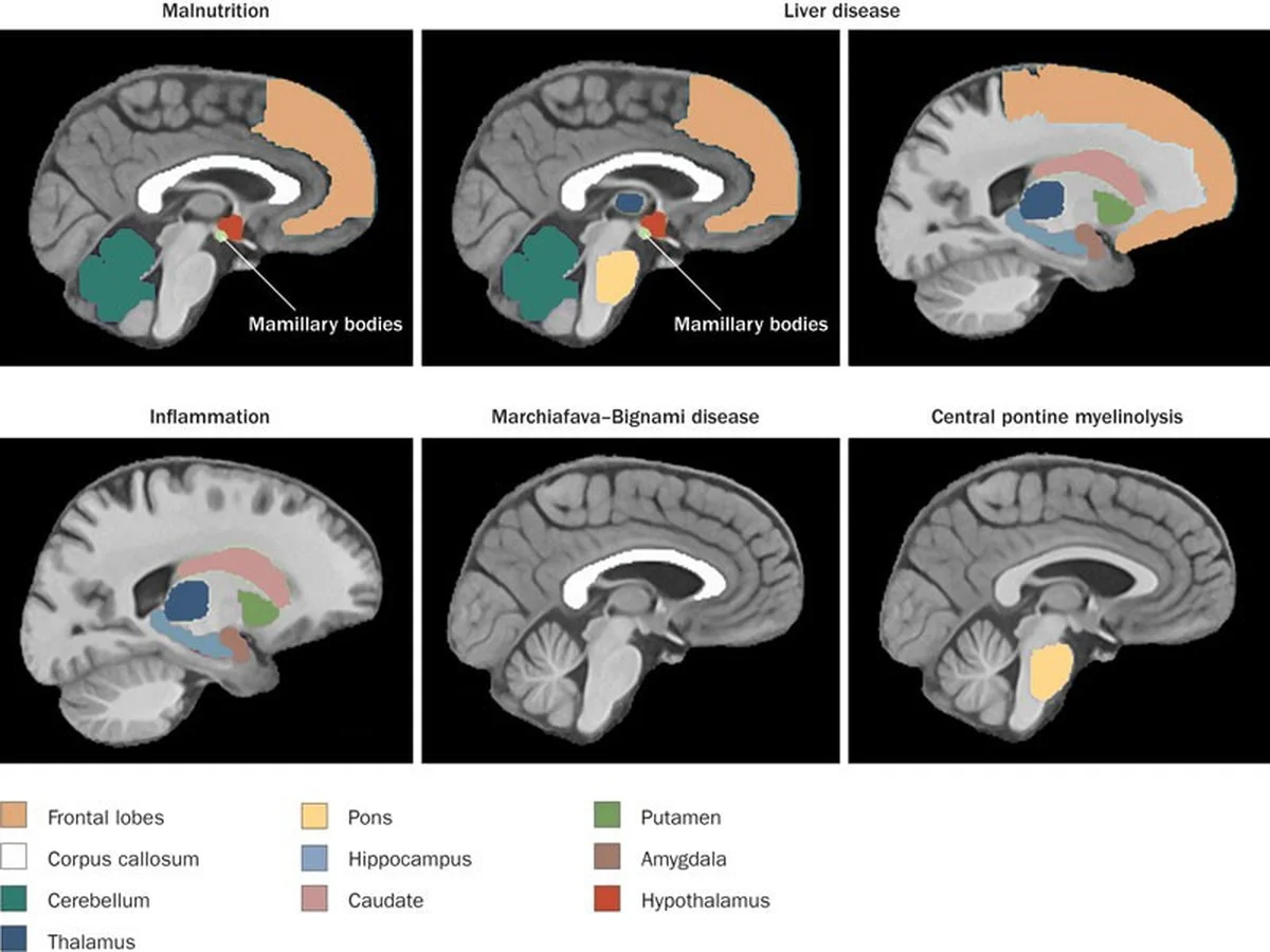 Dieses eine Getränk beschleunigt Ihr Krebsrisiko – aber Ihr Kater kaschiert es - image 1