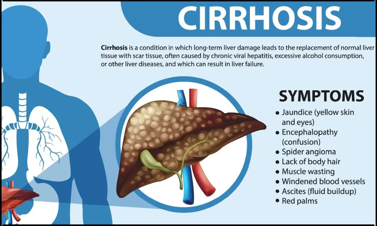 Dieses eine Getränk beschleunigt Ihr Krebsrisiko – aber Ihr Kater kaschiert es - image 2
