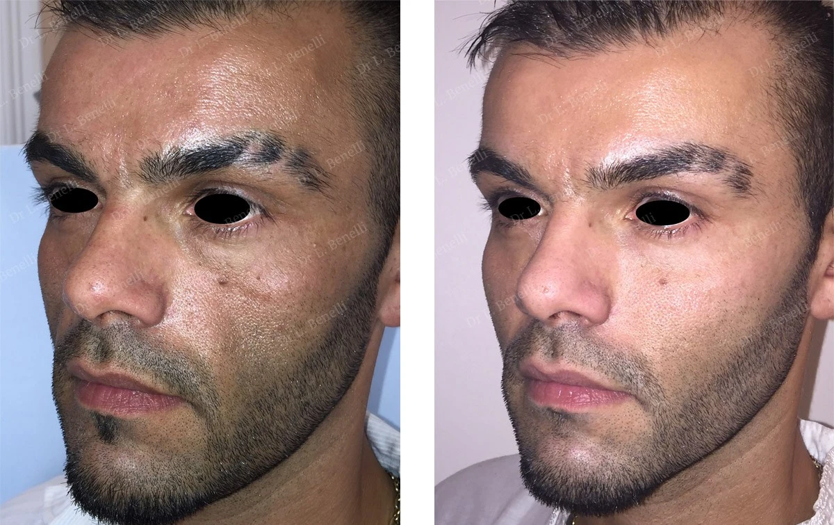 Darum haben ECHTE Männer Angst vor dieser kleinen Operation am Auge - image 1