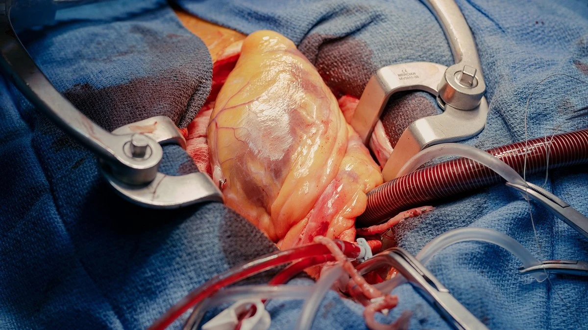 Der Herzchirurg hatte fast alle Werte im Griff – bis er diesen einen Alltagsfehler machte. - image 2