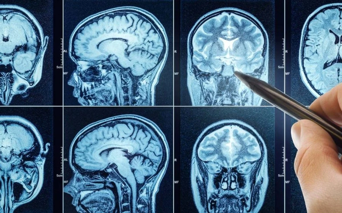 Forscher halten Altruismus nicht für Zufall: Dieses 12-Euro-Gehirn-Tricking stoppt Gier sofort - image 1