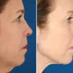 Warum ich 33.000 Dollar für mein Gesicht ausgab – und wie mein Immobilien-Erfolg dadurch explodierte.